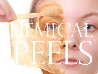 Chemical Peels