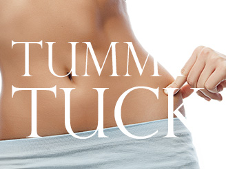 Tummy Tuck