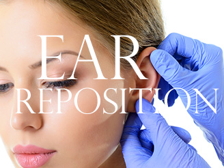 Ear Reposition