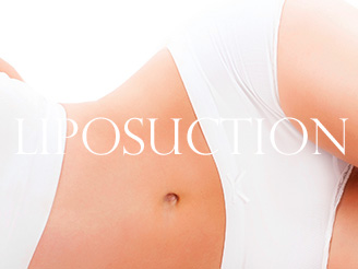 Liposuction